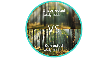 Image floue d'une forêt avec un astigmatisme non corrigé comparée à une image claire et nette d'une forêt avec un astigmatisme corrigé