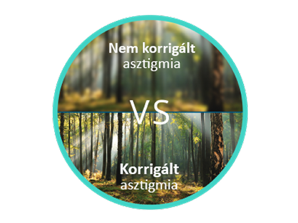 Erdő elmosódott képe nem korrigált asztigmiával, összehasonlítva az éles és fókuszált képpel korrigált asztigmia esetén