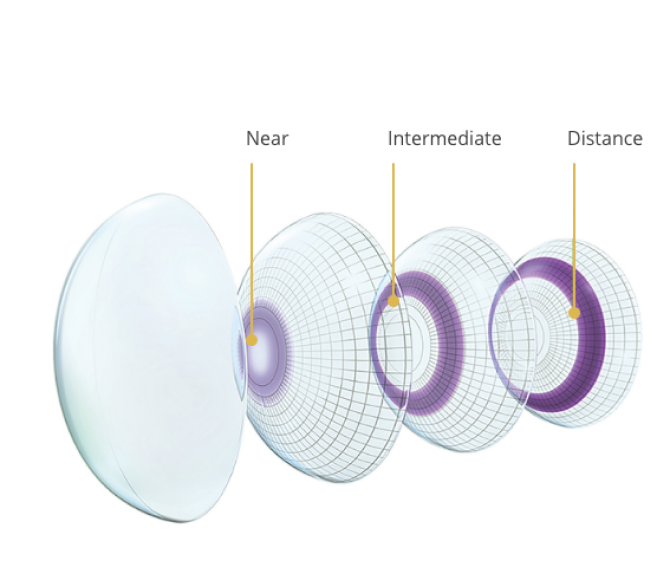 Multifocal lenses