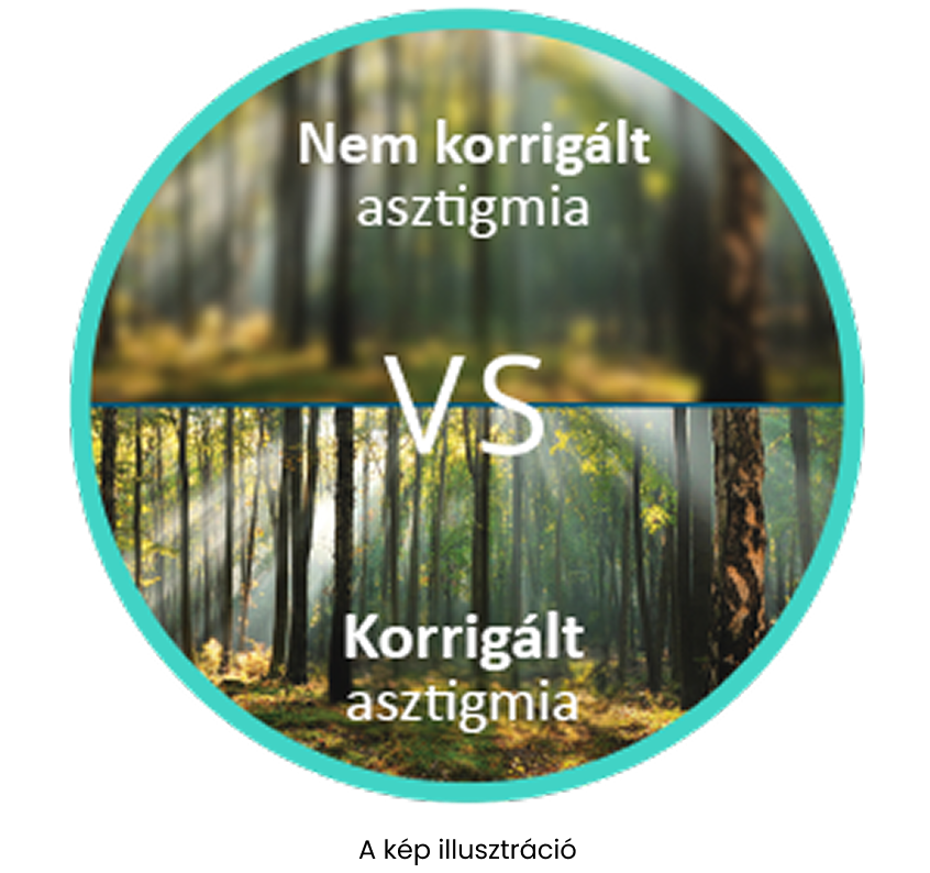 Erdő elmosódott képe nem korrigált asztigmiával, összehasonlítva az éles és fókuszált képpel korrigált asztigmia esetén