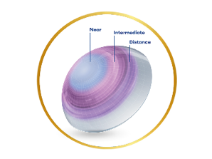 Precision Profile diagram showing a multifocal contact lens sitting on an eyeball labeling the inner to outter rings with transitions for near, intermediate, and distance vision