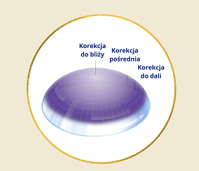 Image of contact lens with description